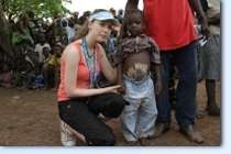 Hayley looks at the leg of a child affected by Guinea Worm. A disease resulting from drinking dirty water.
